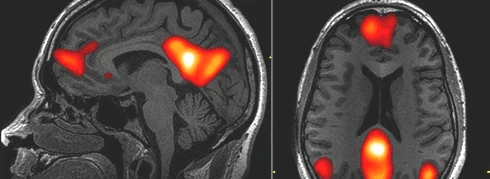 blog-header-image-mri-of-brain-002.png